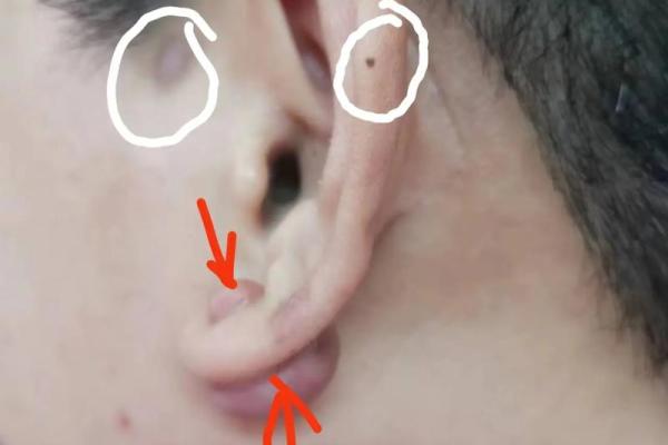 耳朵风水里代表什么