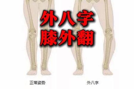八字型腿