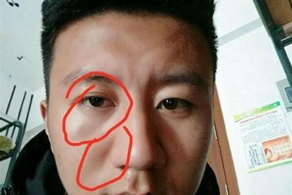 皱眉有八字 皱眉有八字