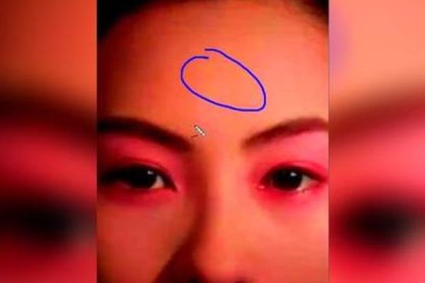 额头胎记算命 额头胎记算命