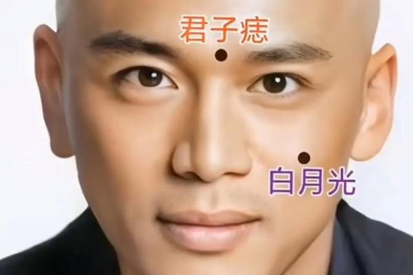 男人脸部有痣,算命你运势好坏 男人脸部有痣,算命你运势好坏