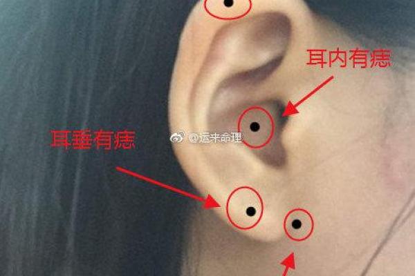 脸的各部位胎记算命详解