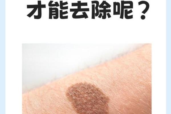 看胎记颜色类型算命 看胎记颜色类型算命