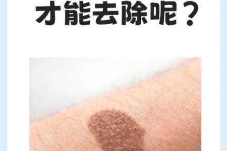 看胎记颜色类型算命