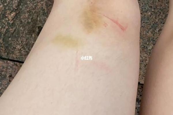 开车摔跤了还能去算命吗