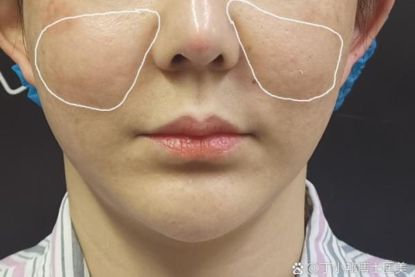 八字纹填充 八字纹填充