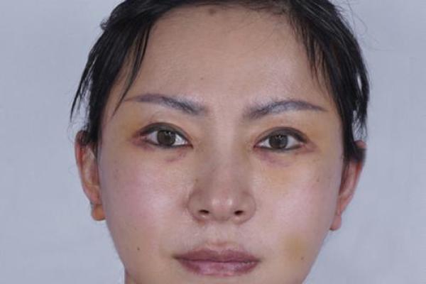 八字纹,八字纹是什么样子图片