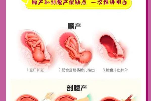 剖腹产的八字 剖腹产的八字