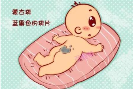 腿上有胎记算命分析