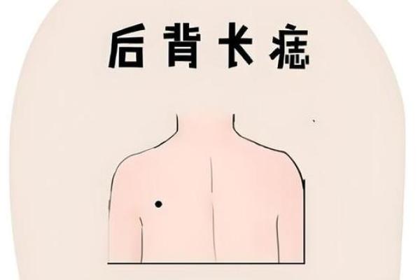 风水上后脑勺长痣代表什么意思 风水上后脑勺长痣代表什么意思