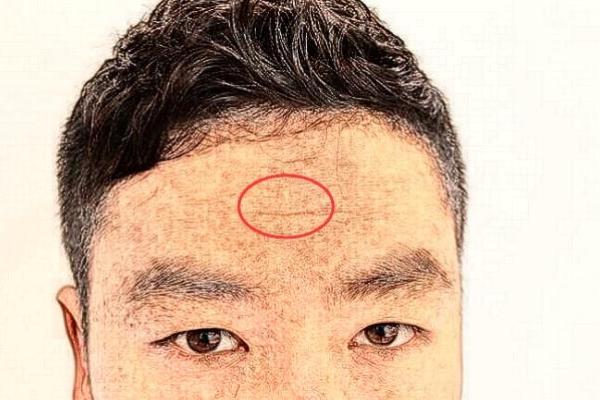 风水额头窄的男人是穷命