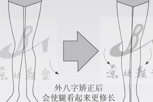 内八字和外八字