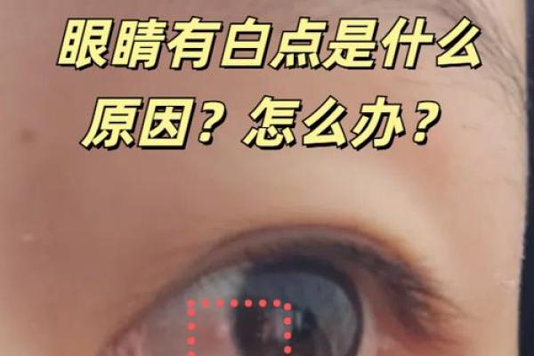 算命左眼白眼球有痣代 算命左眼白眼球有痣代