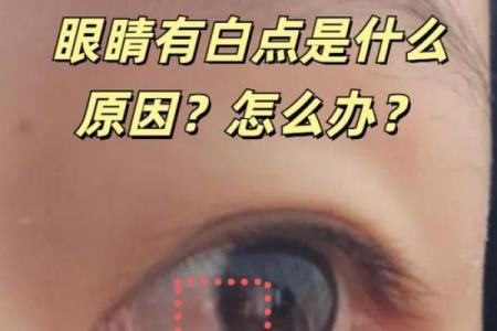算命左眼白眼球有痣代