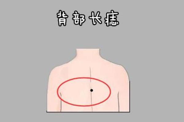 据脖子上胎记算命，有什么说法