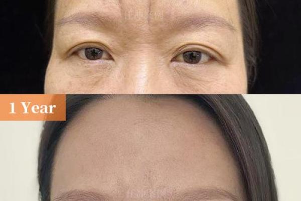 八字脸是什么脸型  八字脸的男人面相