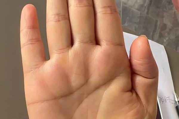 风水手相：生命线短的女人短命吗