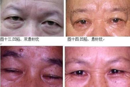 风水上印堂发黑是不是跟了鬼