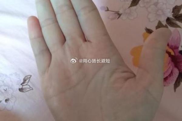 算命的说，手腕上有这样的纹路，一定会破财！